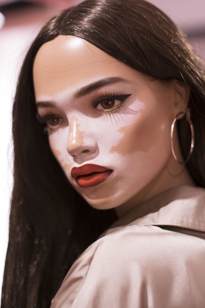 missguided-manequim-vitiligo