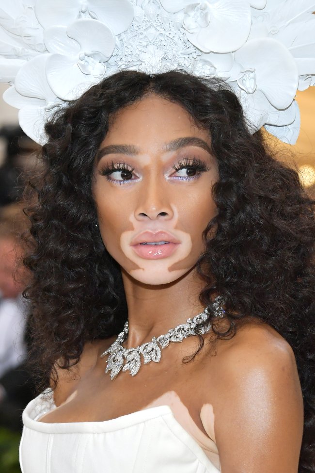 Winnie-Harlow-met-gala