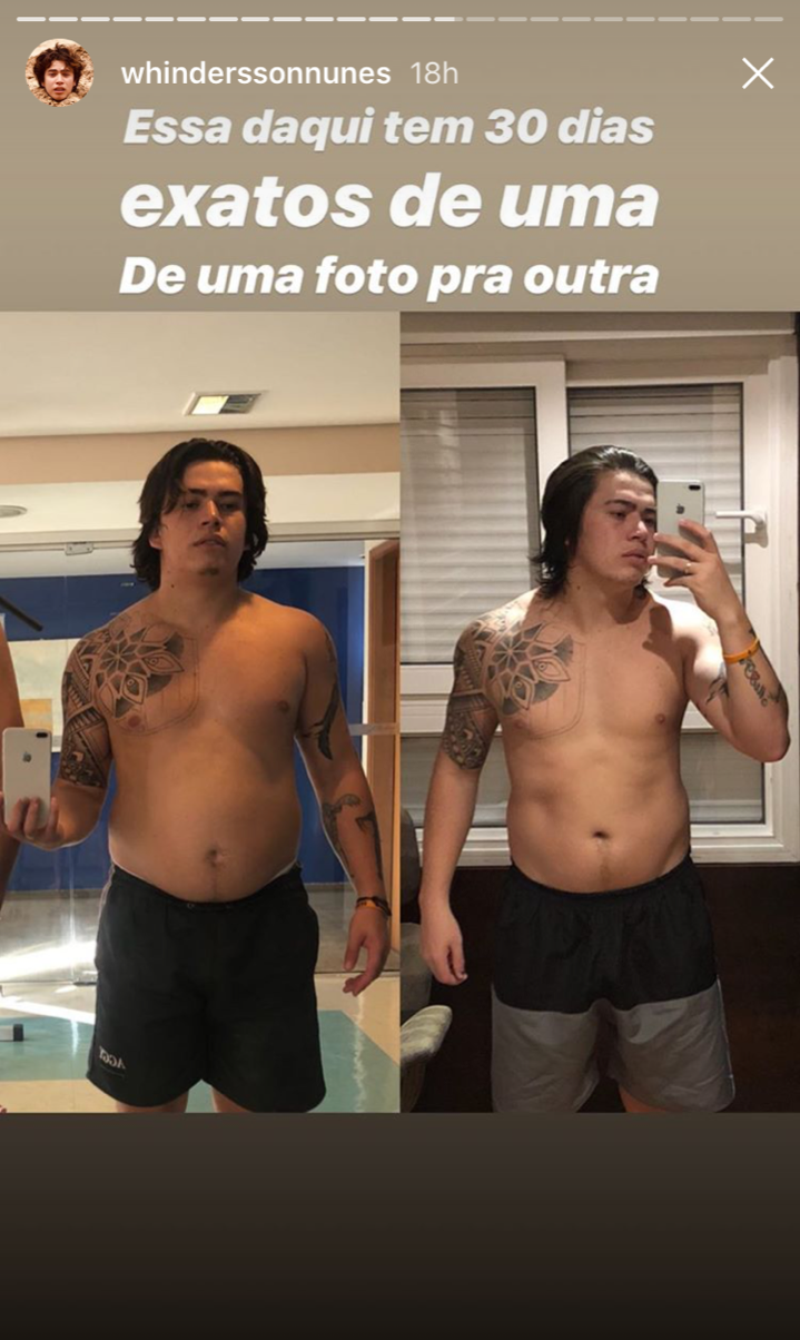 whindersson-nunes-gordura-figado-antes-e-depois