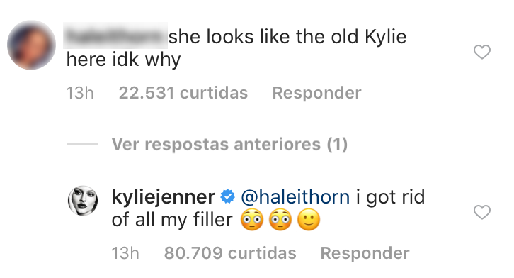 kylie-jenner-parou-de-usar-preenchimento-labial