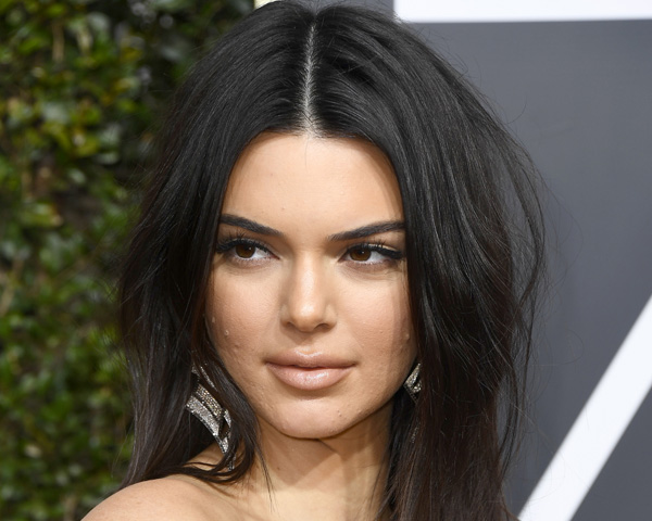 famosas-que-falam-sobre-acne-espinhas-kendall-jenner famosas-que-falam-sobre-acne-espinhas-kendall-jenner