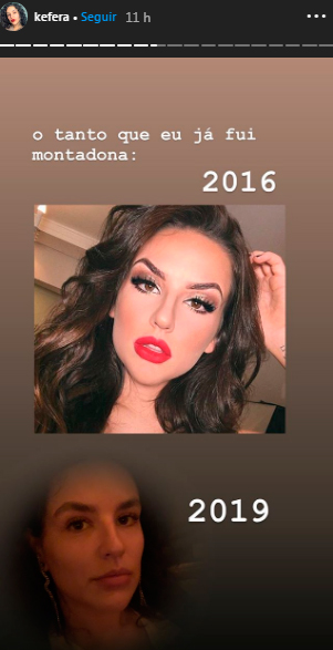 kefera-foto-antes-e-depois