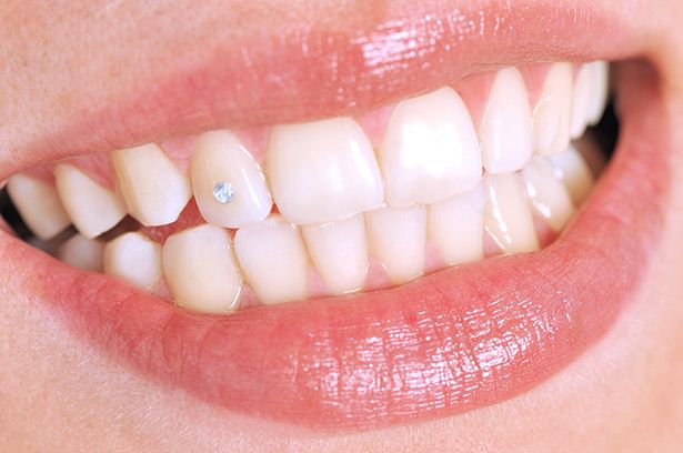 piercing_dente Provas de que a moda dos anos 2000 foi longe demais com o piercing
