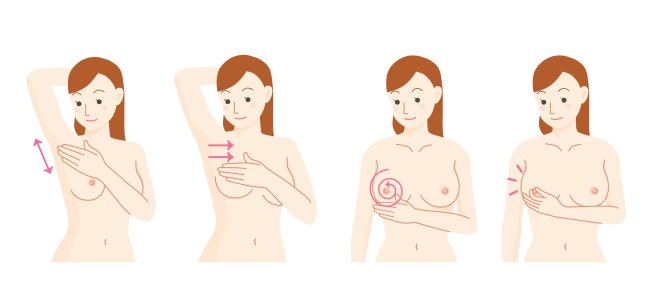 7 mitos e verdades sobre o câncer de mama que toda jovem mulher deve saber Ilustração de como fazer o autoexame de mama em casa